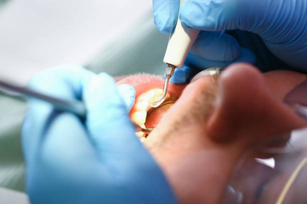 Best Dentist for Tooth Abscess  in Edgecliff Village, TX